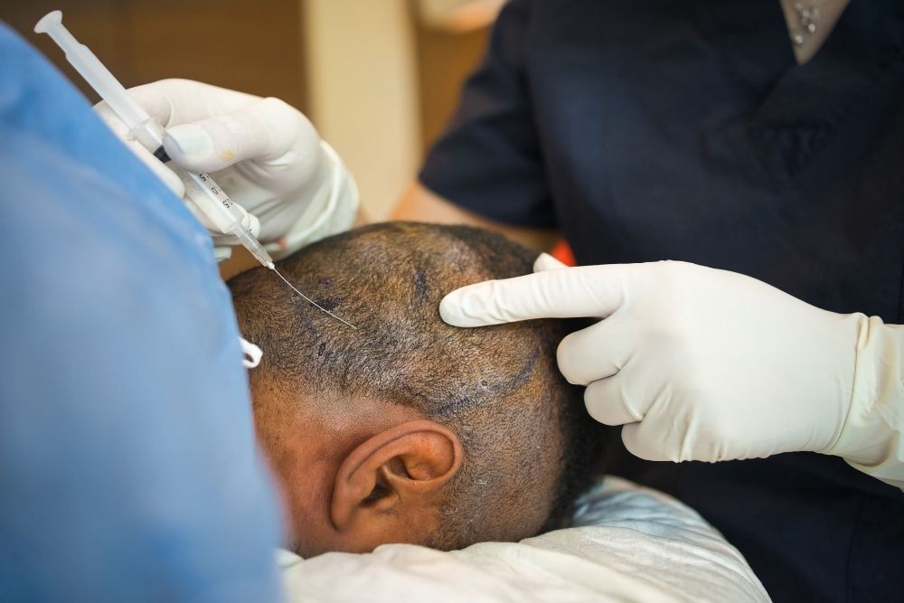 Hair Transplant in mumbai