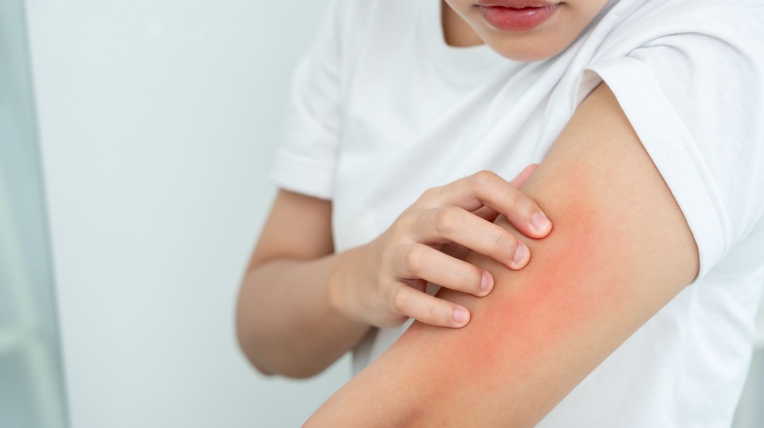 Skin Allergy Treatment