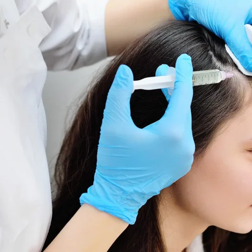 prp-hair-treatment